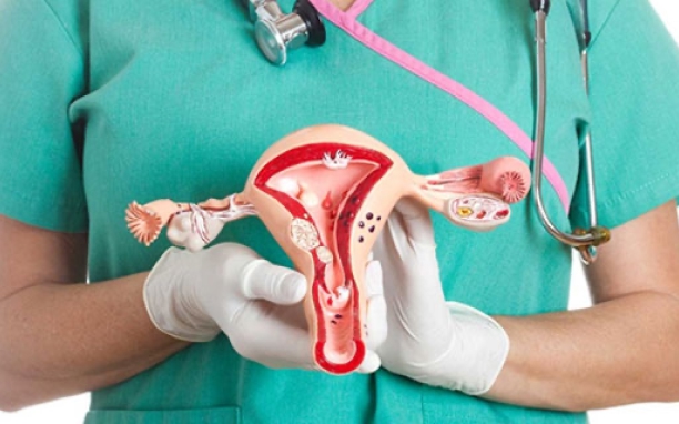 Hysterectomy