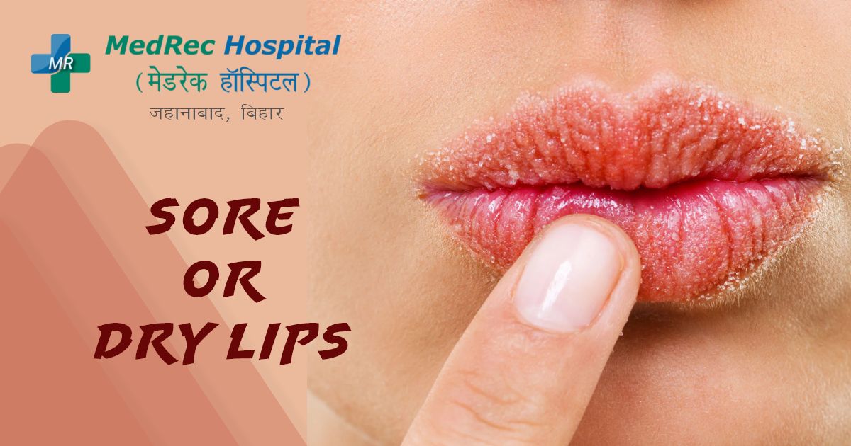 sore lips