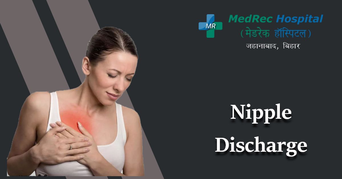 nipple discharge