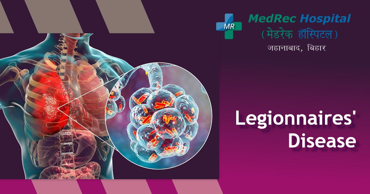 legionnaires disease