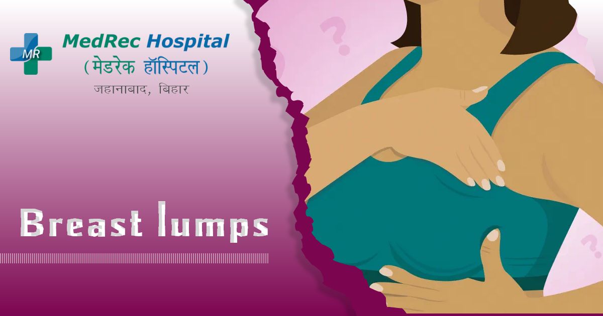 breast lumps