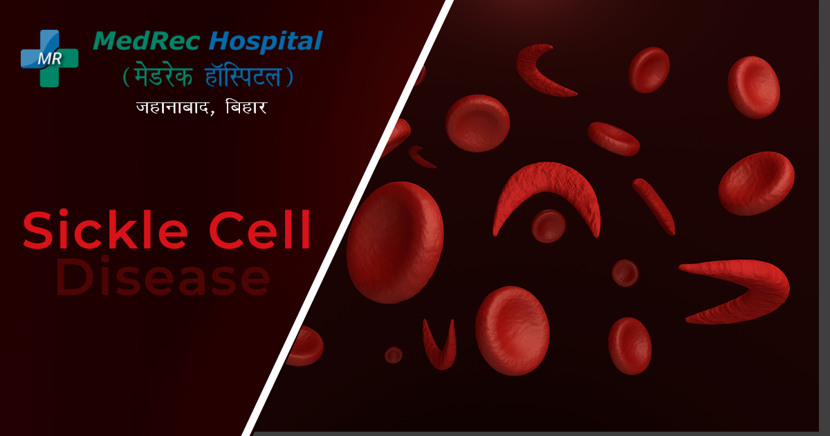 sickle cell disease