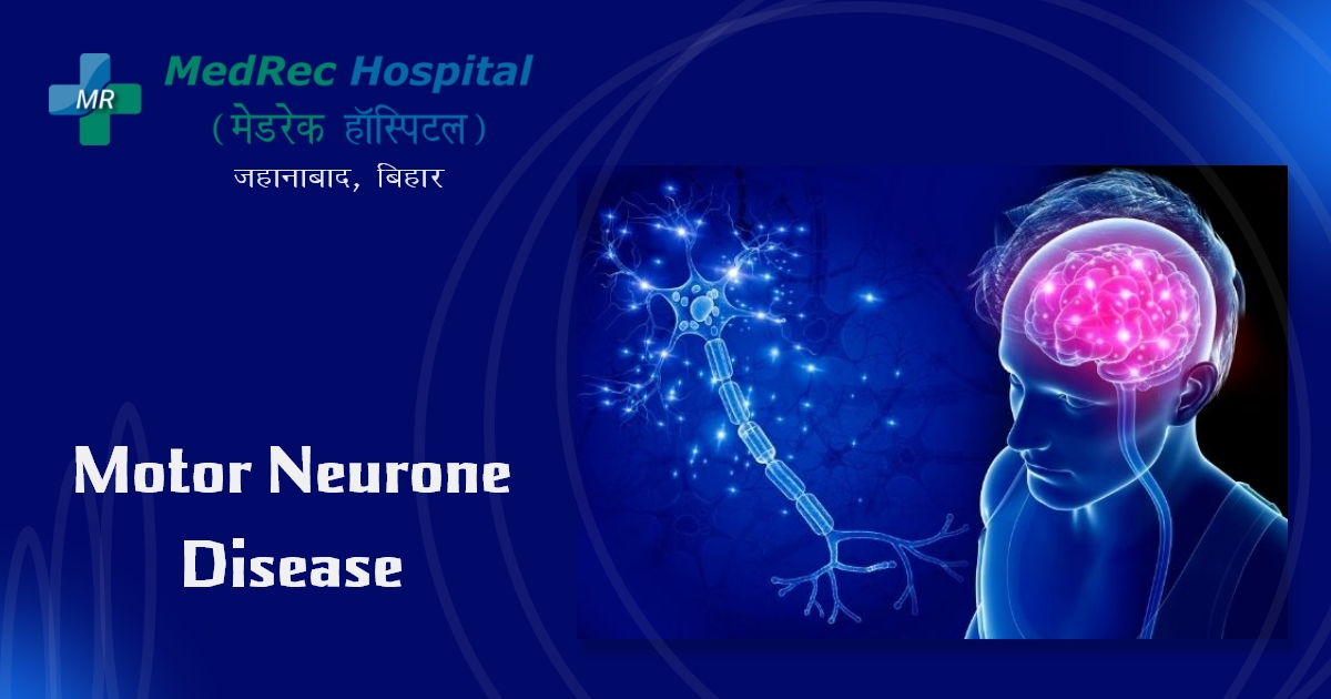 motor neurone disease