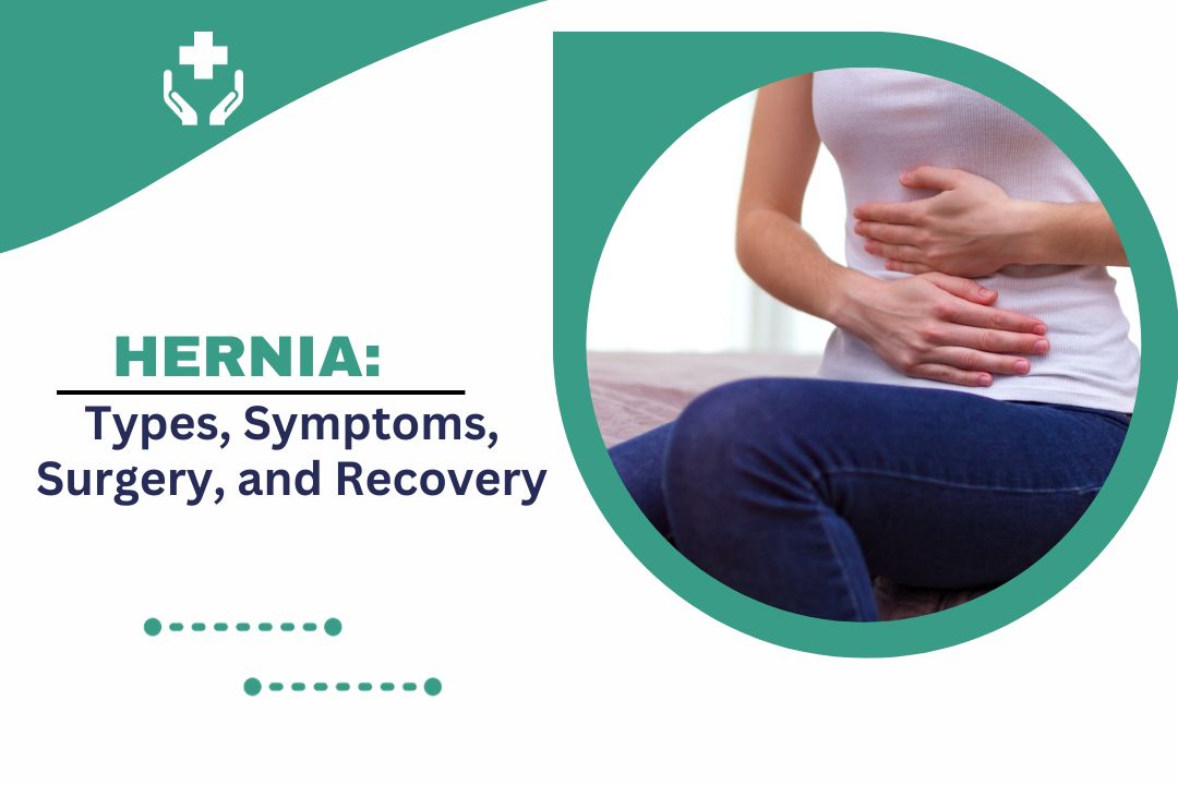 Umbilical Hernia: Symptoms, Treatment, and Recovery Guide