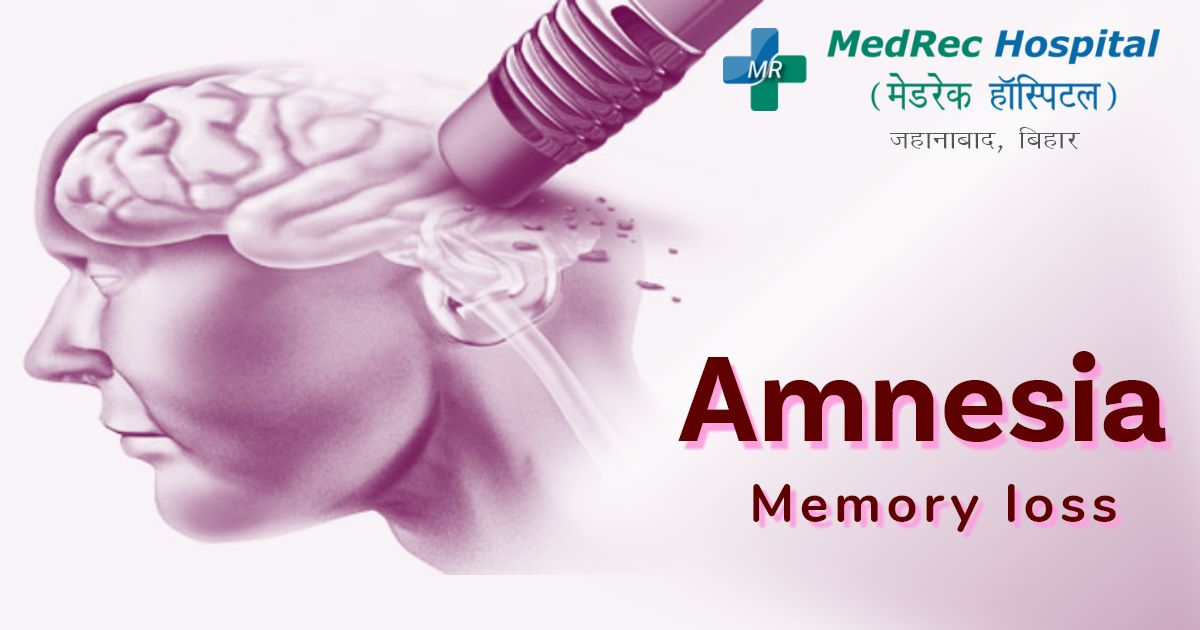 amnesia prevention