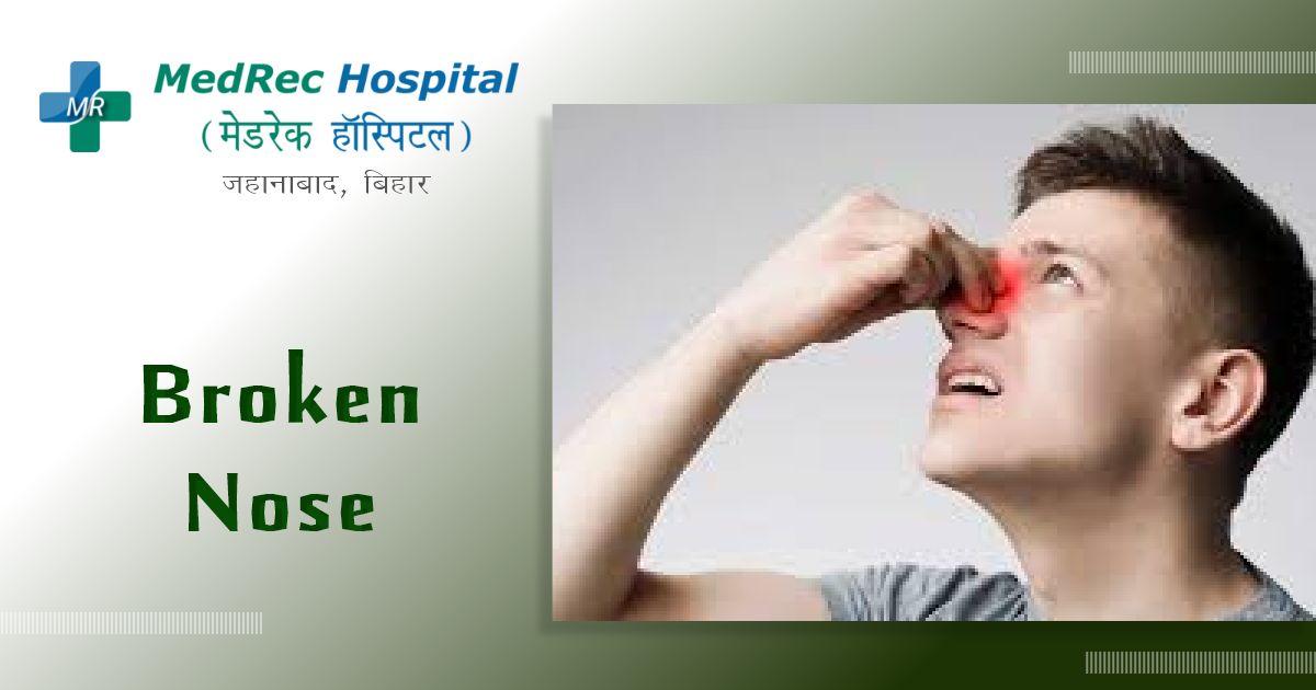 broken your nose