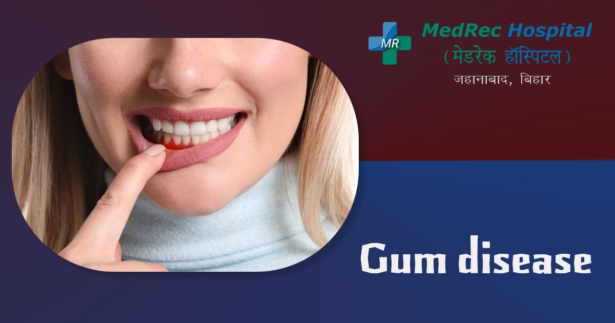 gum disease