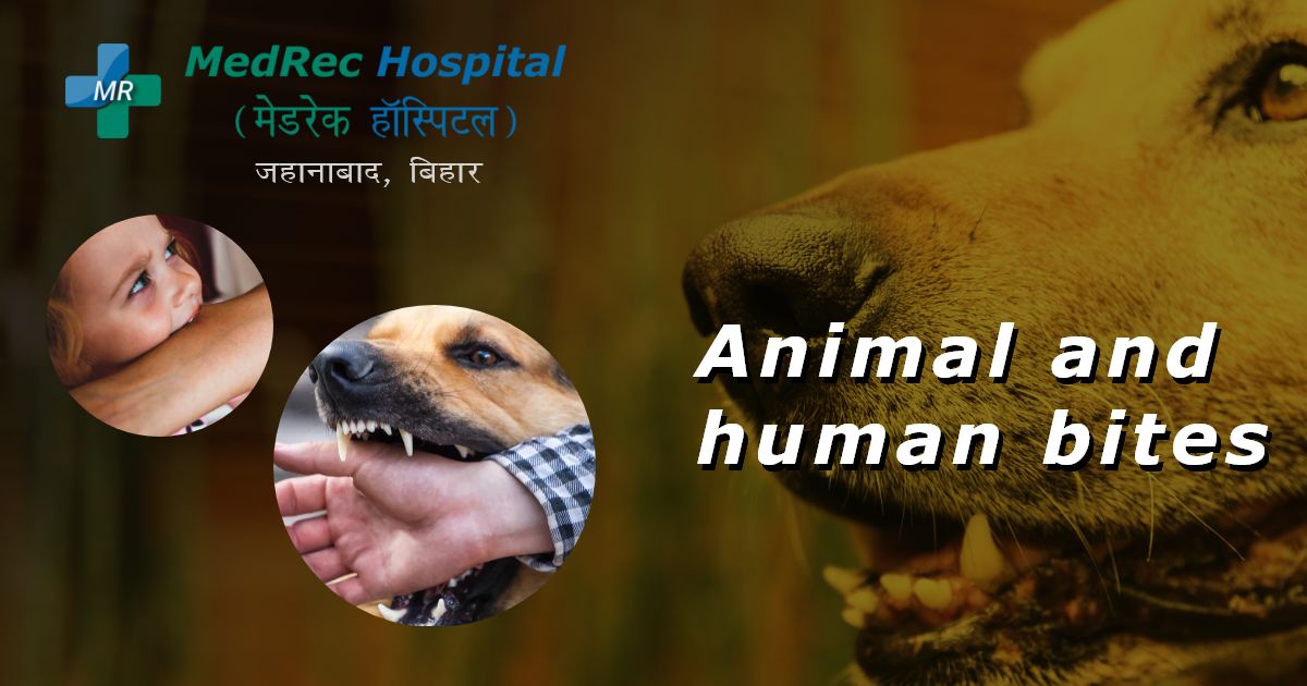 animal and human bites