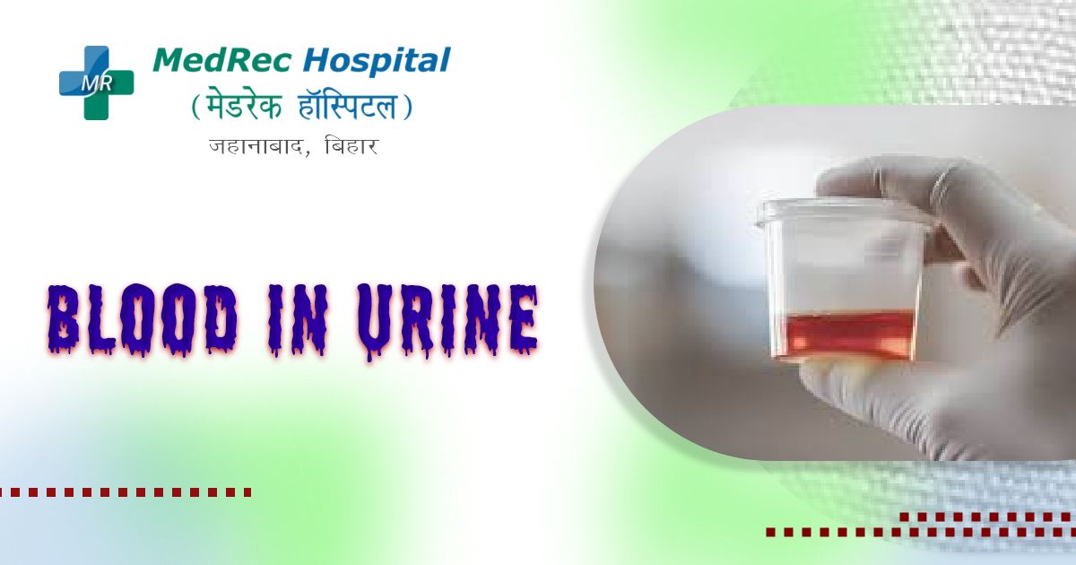 blood in urine