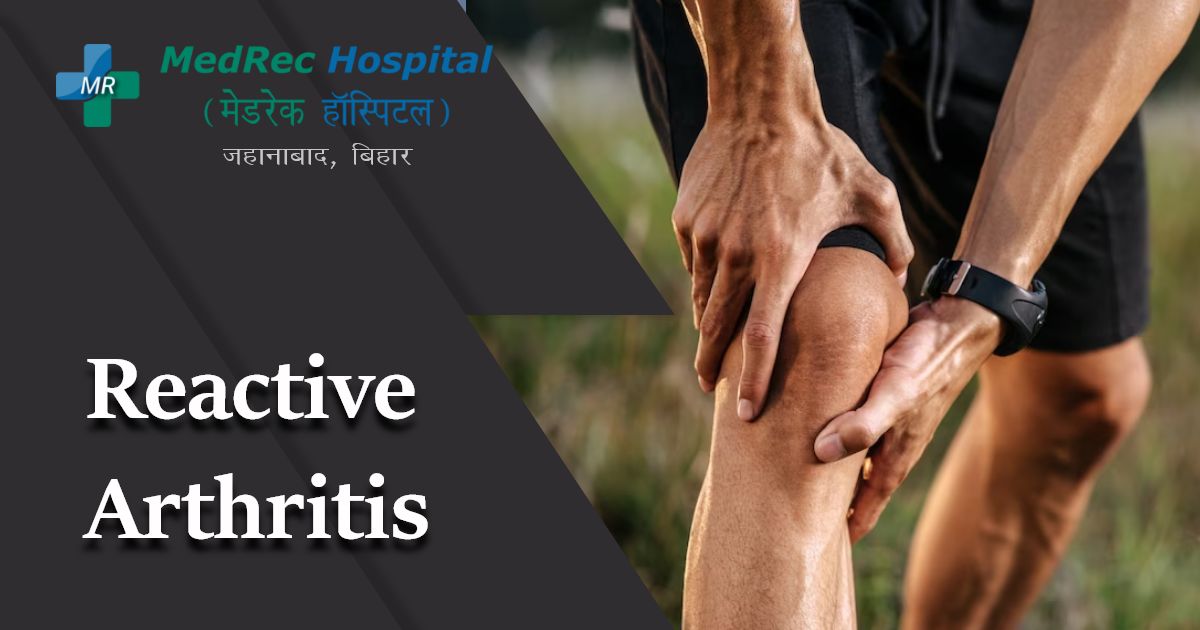 reactive arthritis