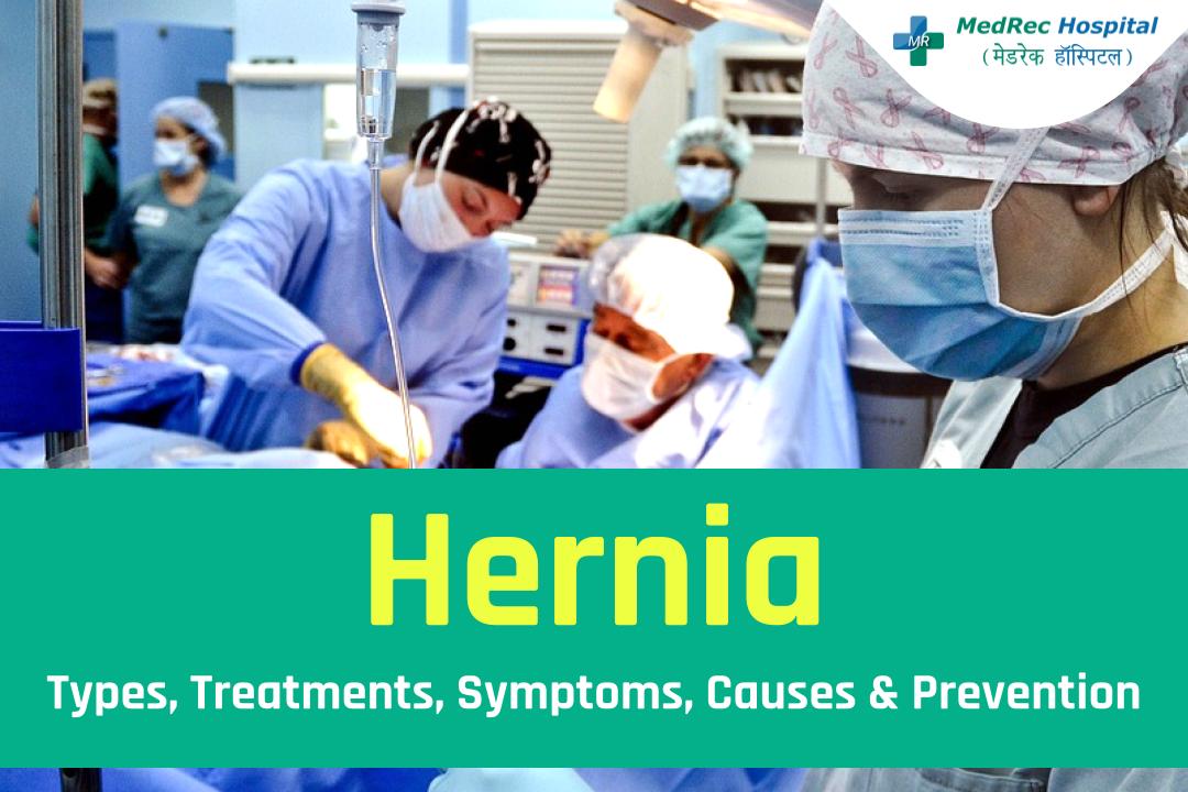 What Is a Femoral Hernia?