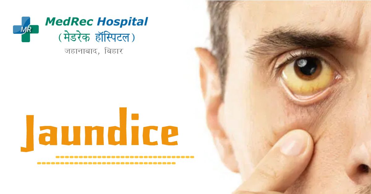 jaundice