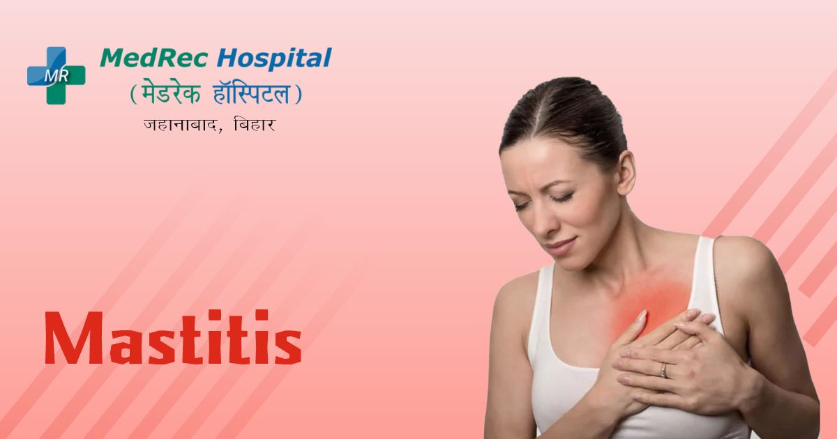 mastitis