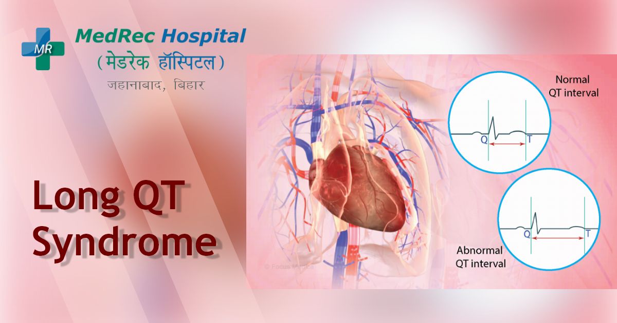 long QT syndrome