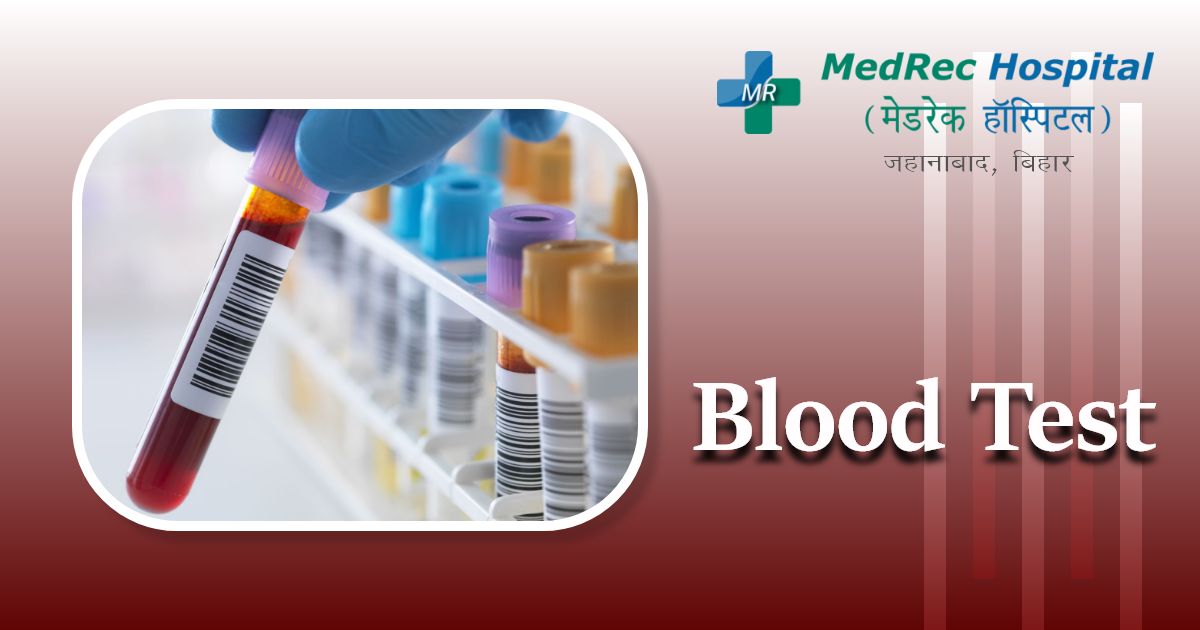 blood test