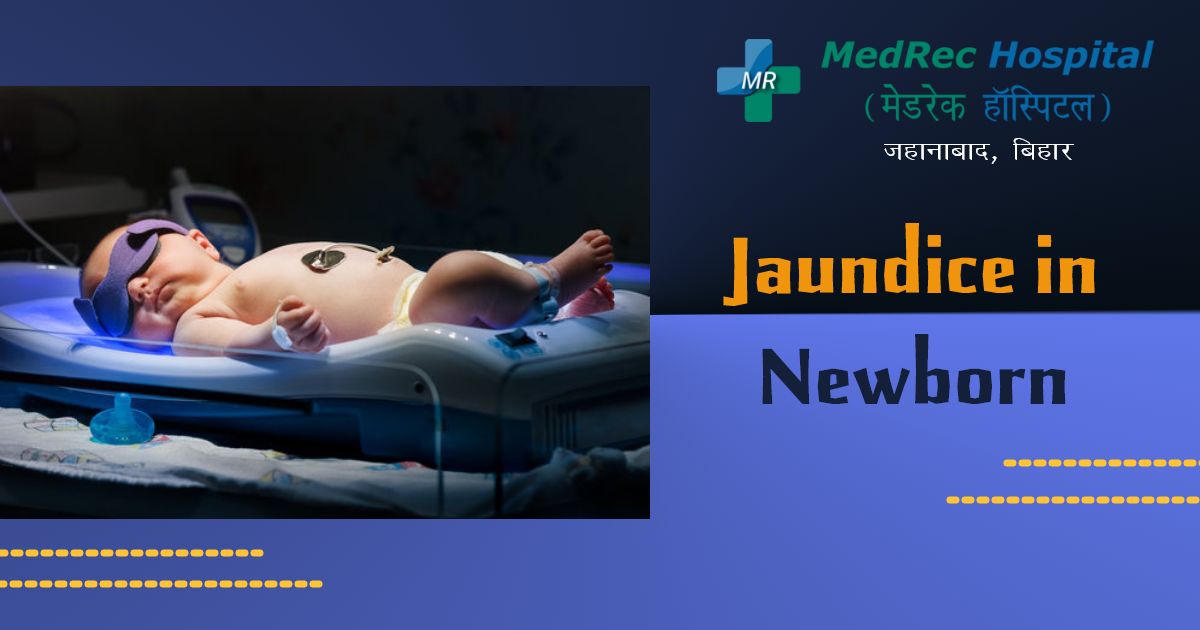 infant jaundice