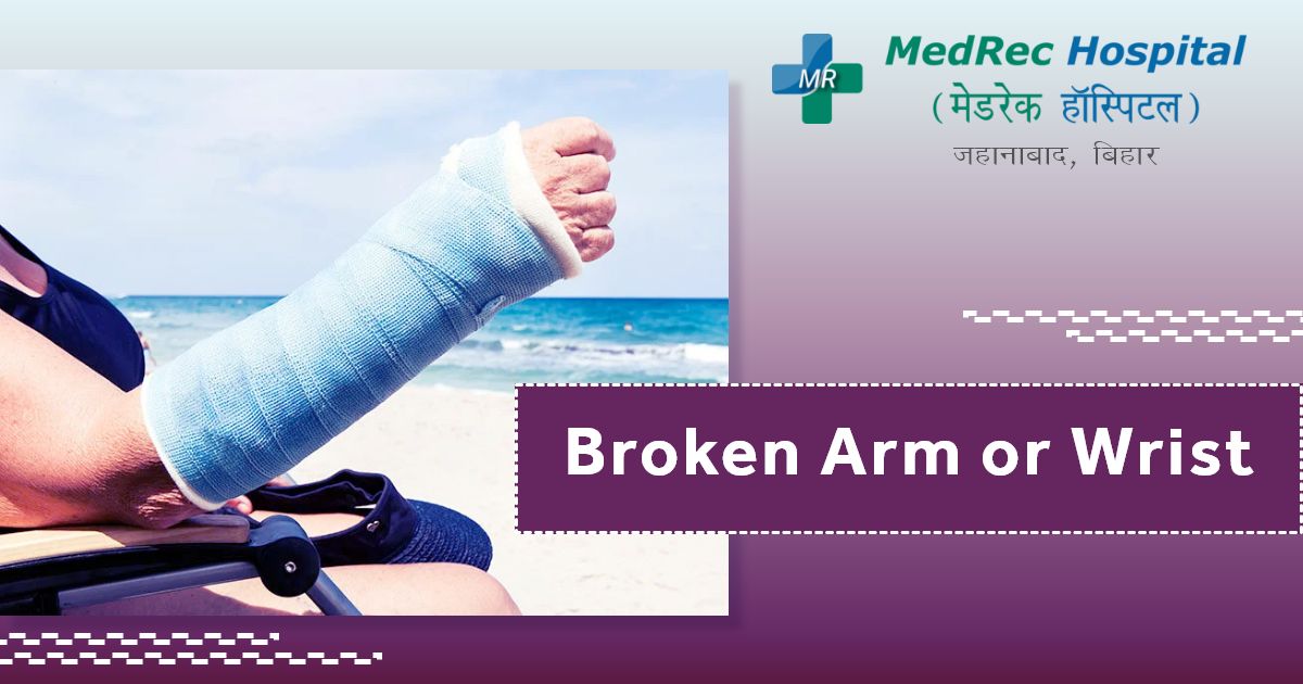 broken arm