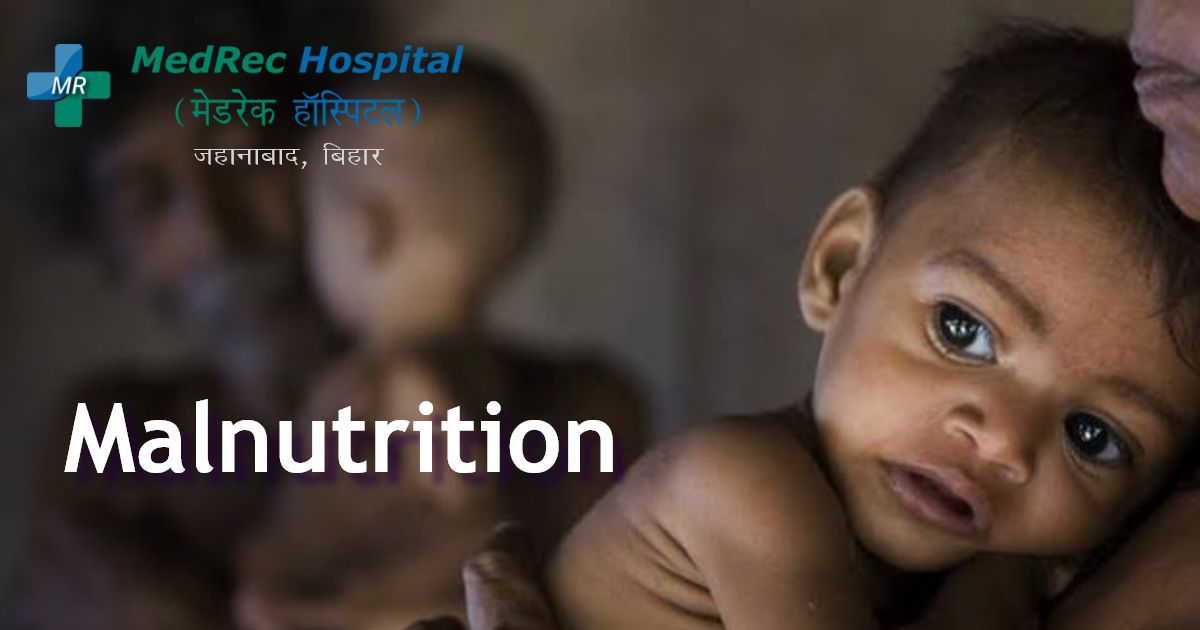 malnutrition