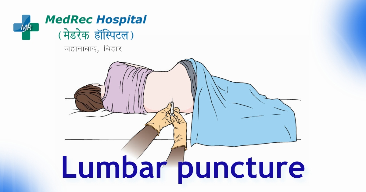 lumbar puncture