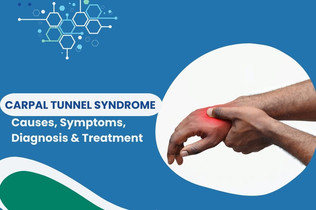 Carpal Tunnel Symptoms, Causes and Treatment