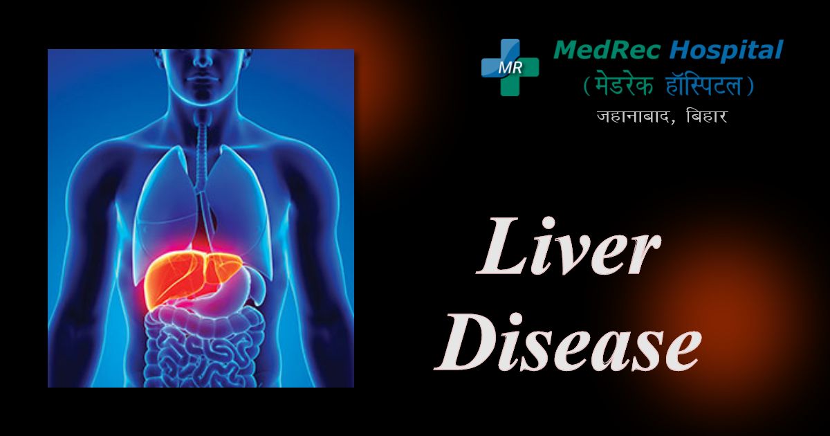 liver disease