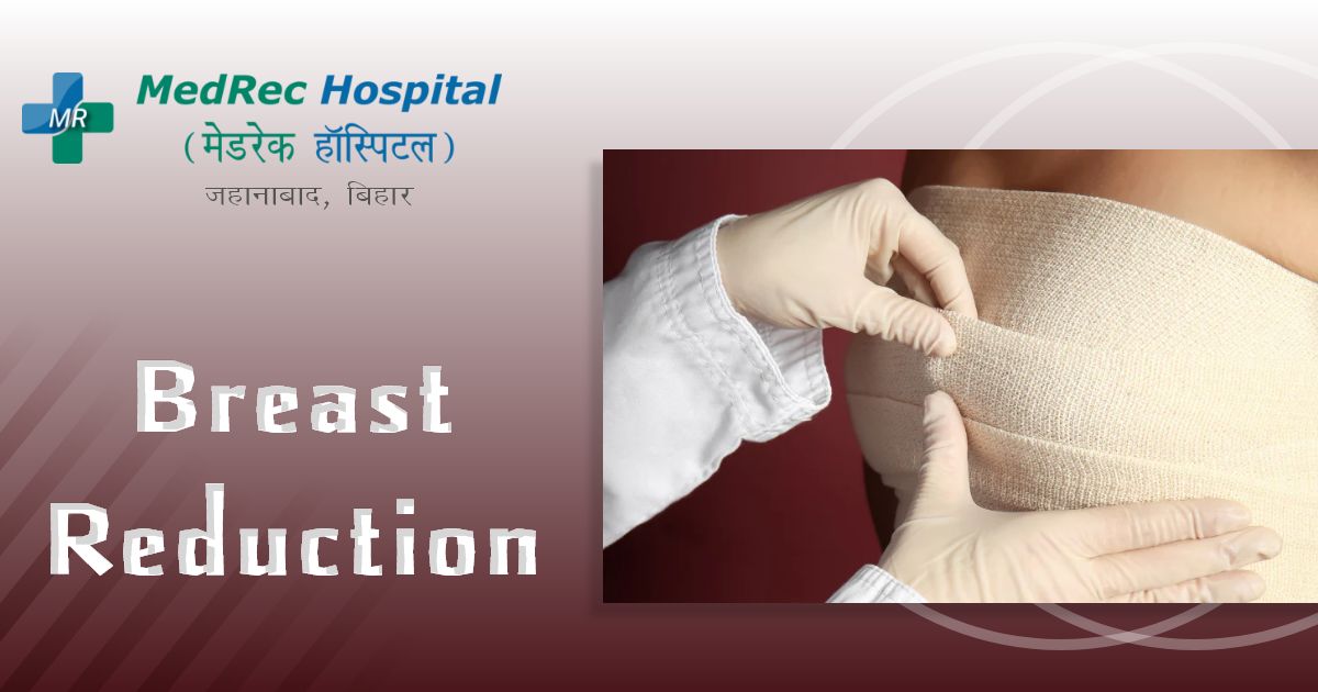 breast reduction surgery