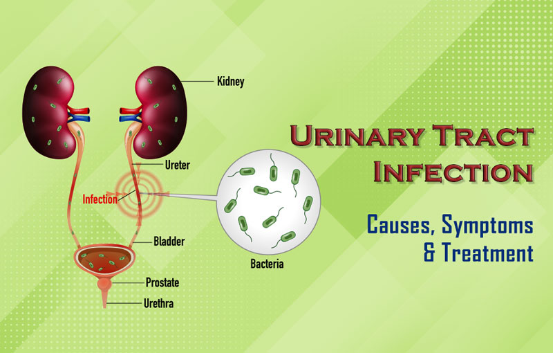 Urinary Tract Infection Causes, Symptoms & Treatment