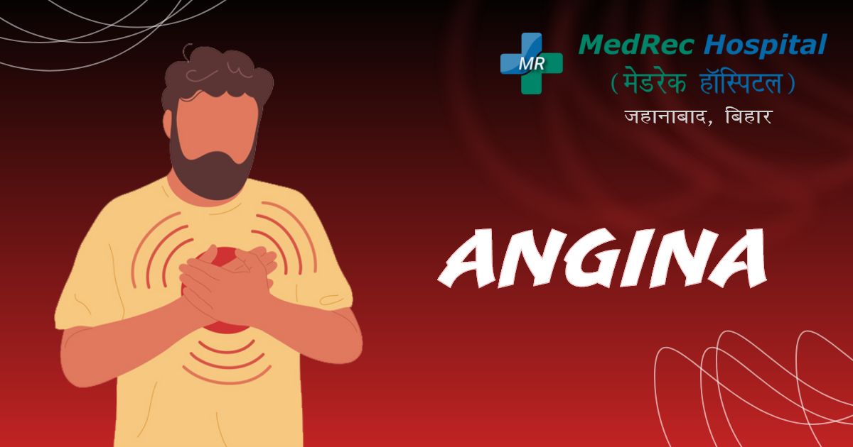 angina