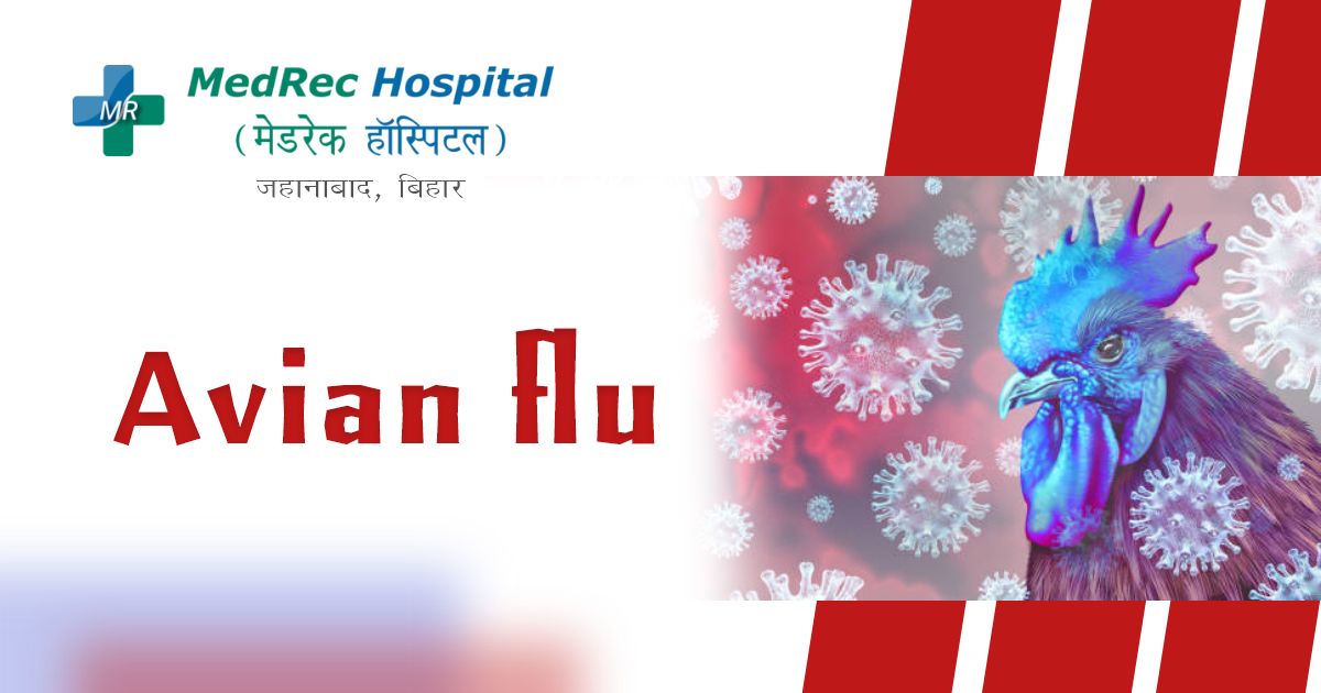 avian flu